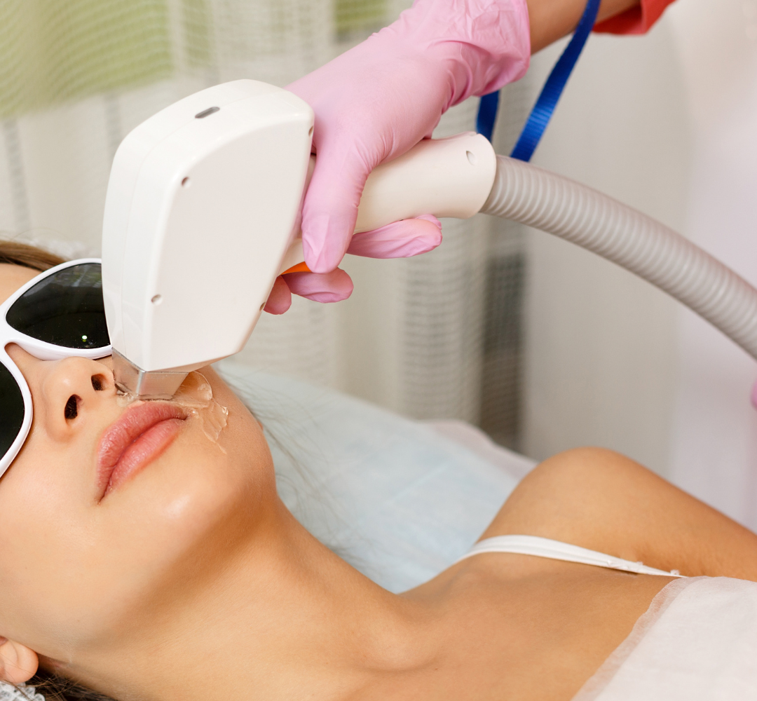 Woman receiving laser treatment on her face with a professional in pink gloves.