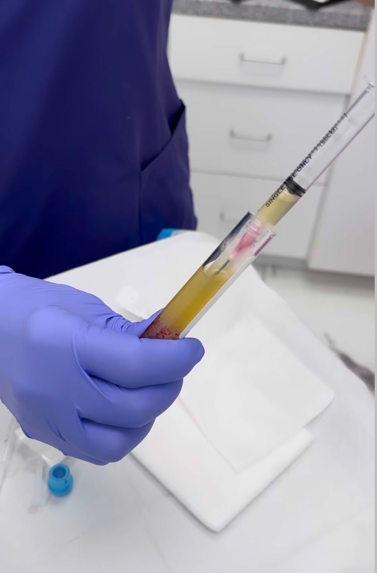 Person in a lab setting holding a syringe with a needle, wearing blue gloves. PRF